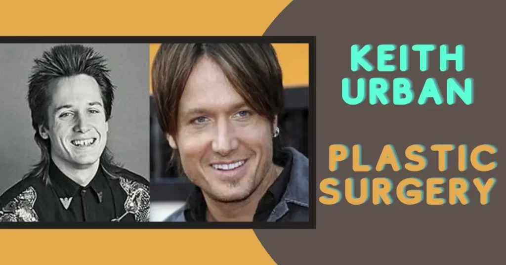 Keith Urban Plastic Surgery