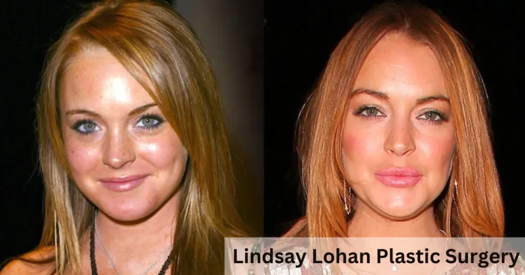 Lindsay Lohan Plastic Surgery