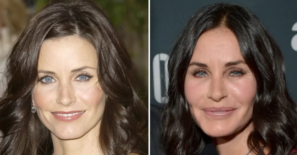 Courtney Cox Plastic Surgery