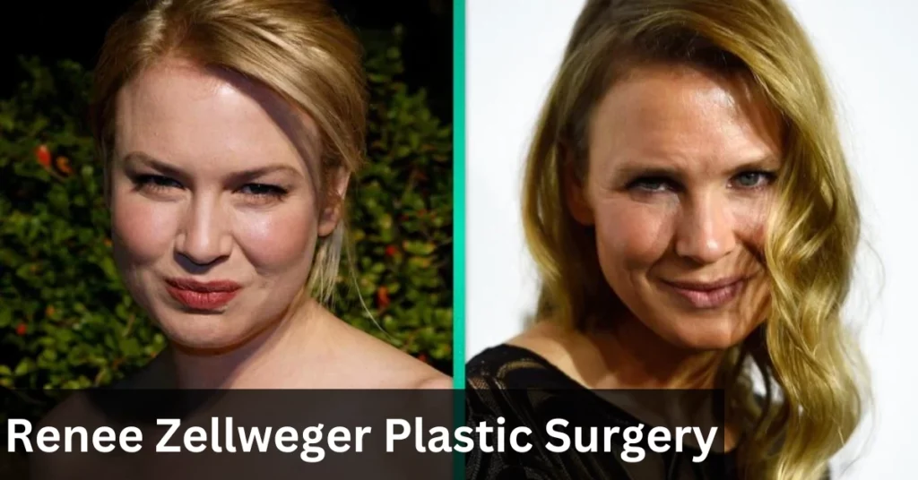 Renee Zellweger Plastic Surgery