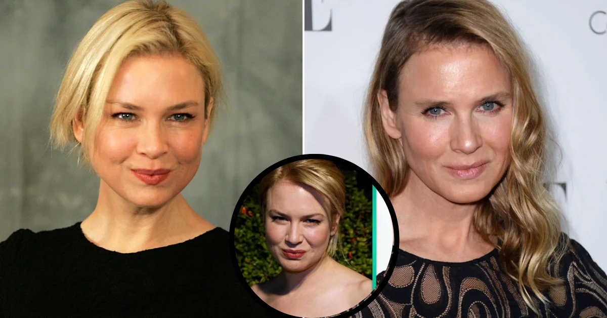 Renee Zellweger Plastic Surgery