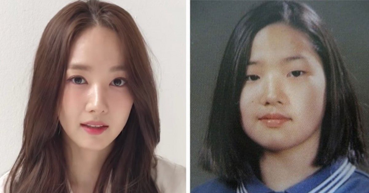 Has Lim Ji Yeon Done Plastic Surgery?